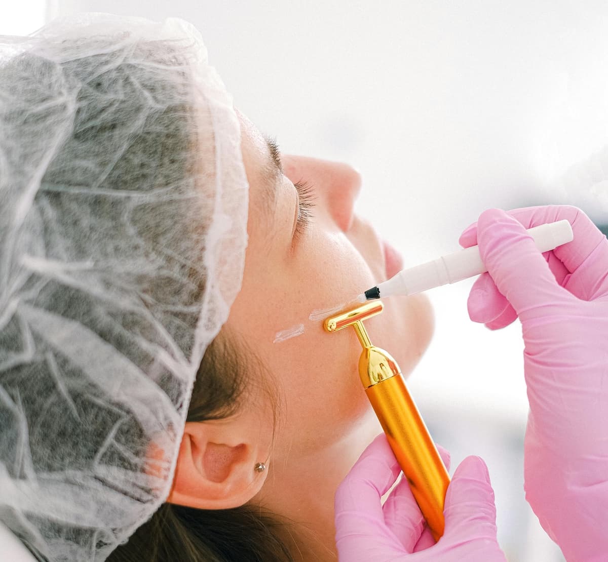Chemical Peel