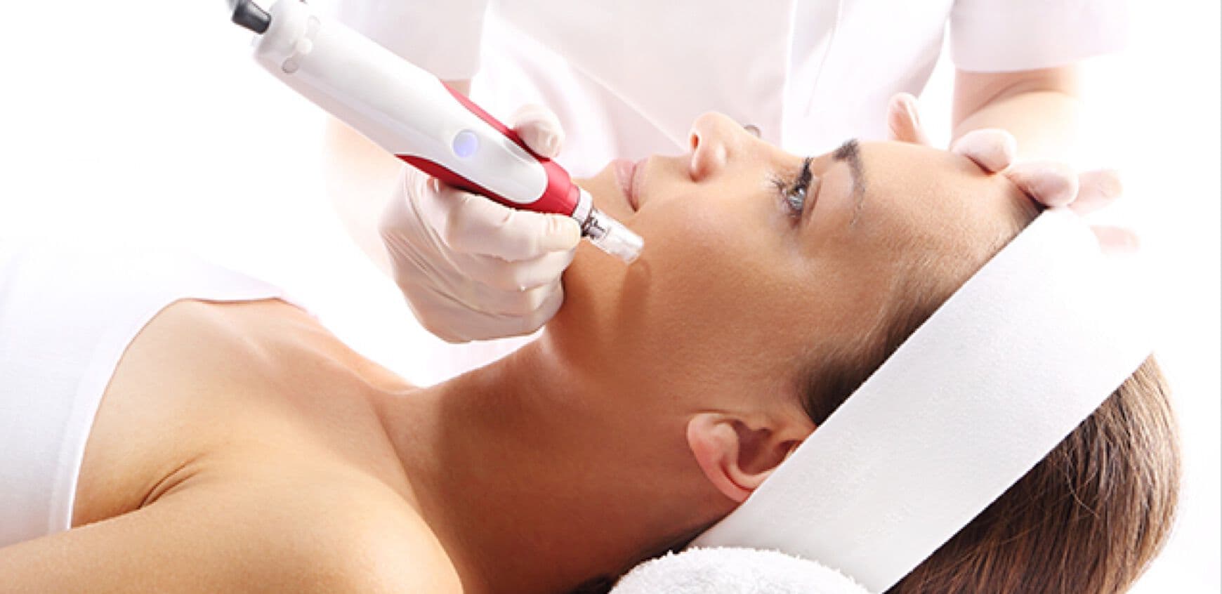 Skin Needling